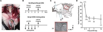 Preceding Administration of Minocycline Suppresses Plastic Changes in Cortical Excitatory Propagation in the Model Rat With Partial Infraorbital Nerve Ligation